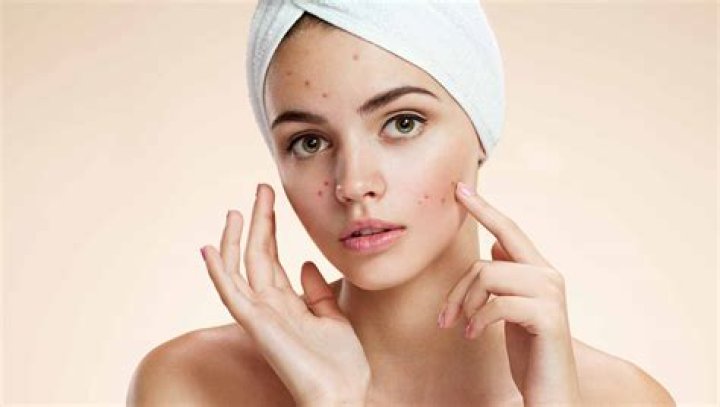 What are 7 common skin problems?