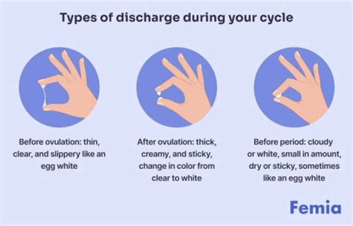 What are the 5 types of discharge?