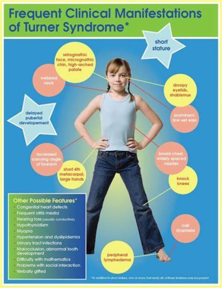 What are the different types of Turner syndrome?