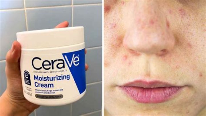 What are the side effects of CeraVe moisturizing cream?
