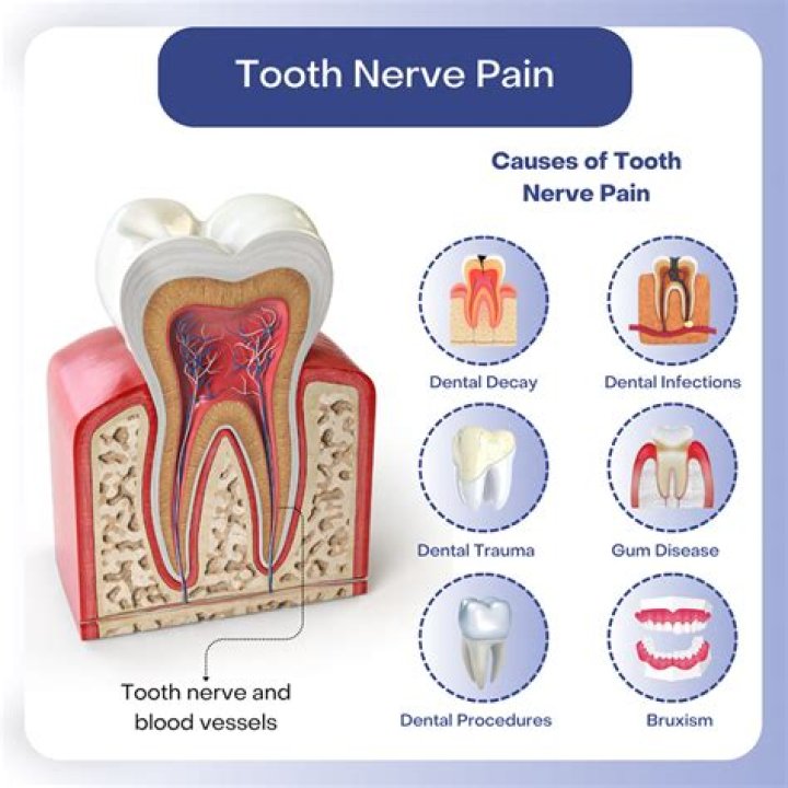 What are the symptoms of a dying nerve in a tooth?