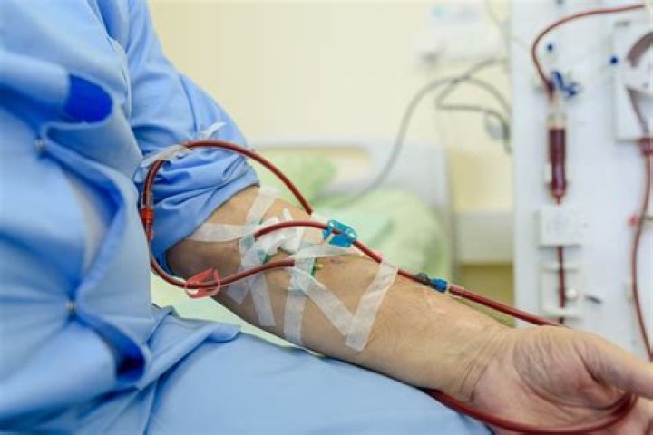 What are the symptoms of last stage of dialysis patient?