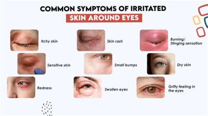 What are two major principles that should be followed to protect the skin around the stoma from irritation and breakdown?