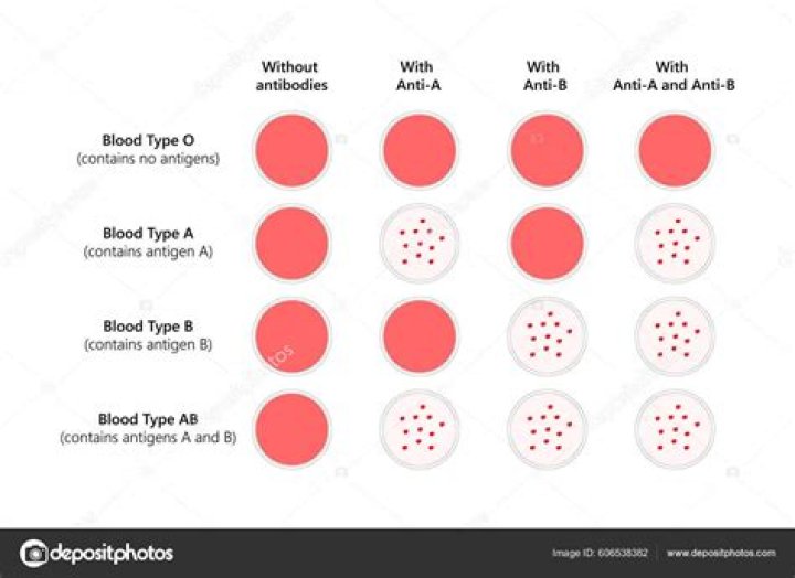 What blood type is least prone to Covid?