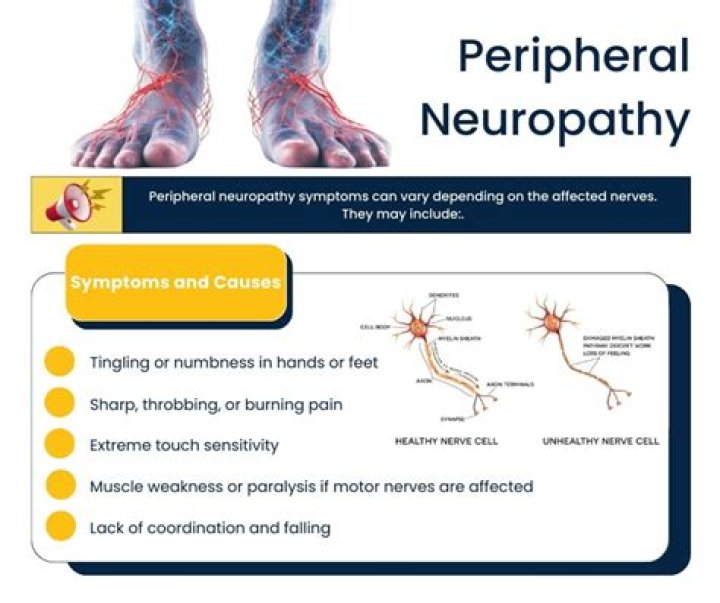 What can a neurologist do for peripheral neuropathy?