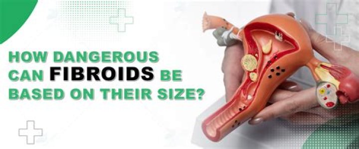 What can dissolve fibroids?