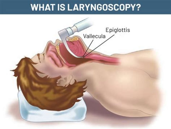 What can you eat after a laryngoscopy?