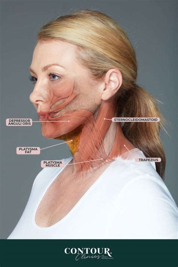 What causes fat under chin?