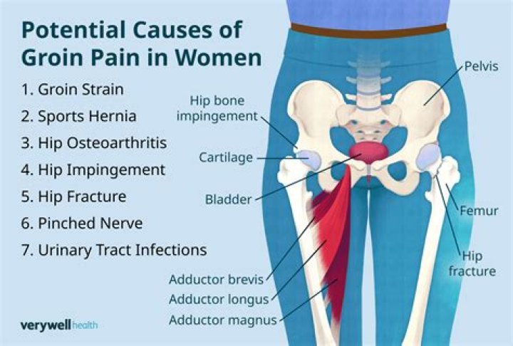 What causes left groin pain in females?