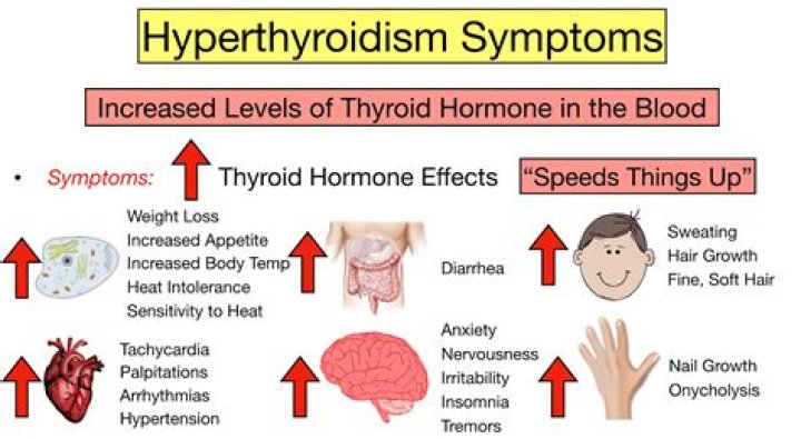 What causes low thyroid?