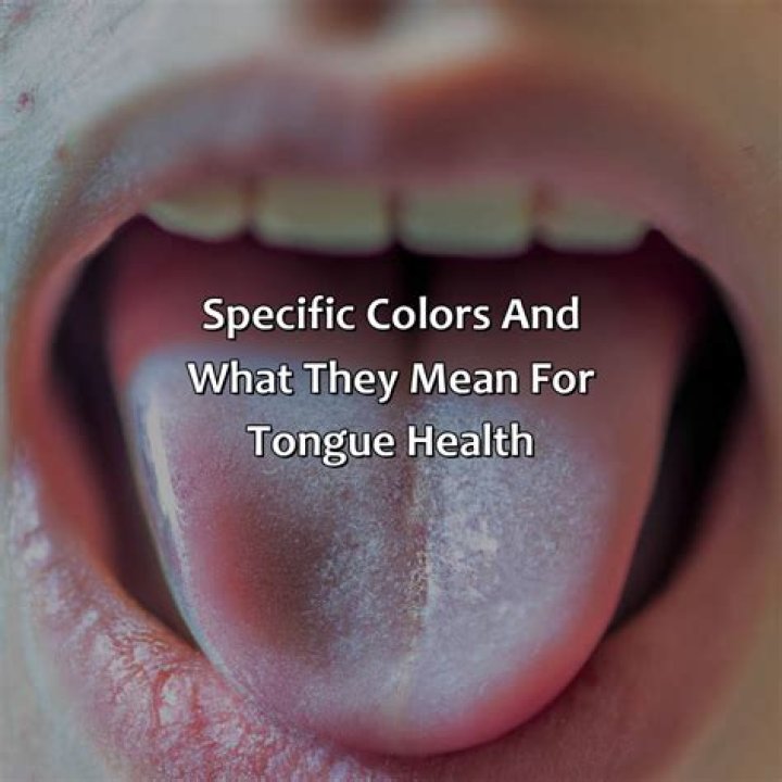 What Colour should my tongue be?