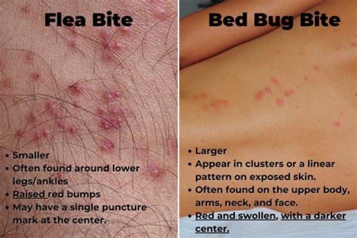 What do Bedbug bites look like on humans?
