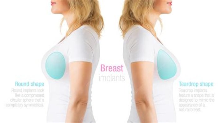 What do boobs look like right after implants?