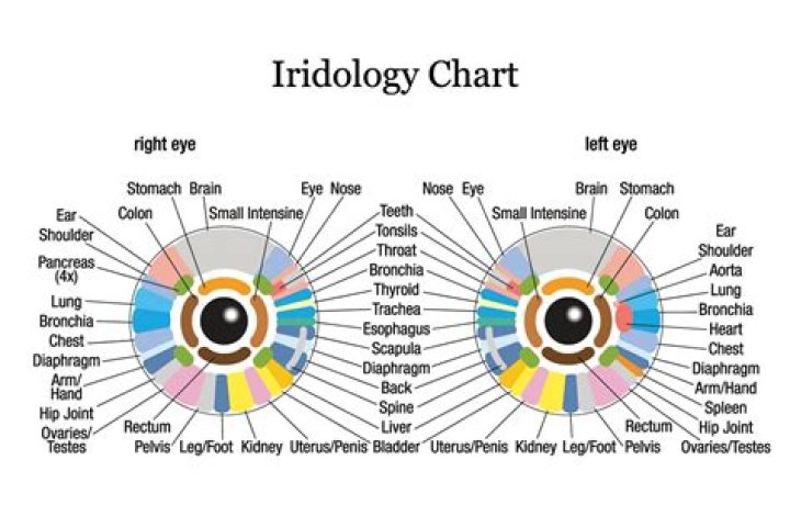 What do brown spots in your iris mean?