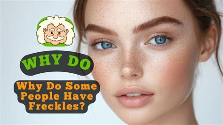 What do freckles symbolize?