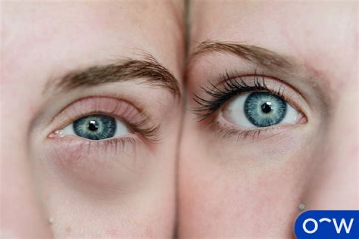 What do Medusa's eyes look like?
