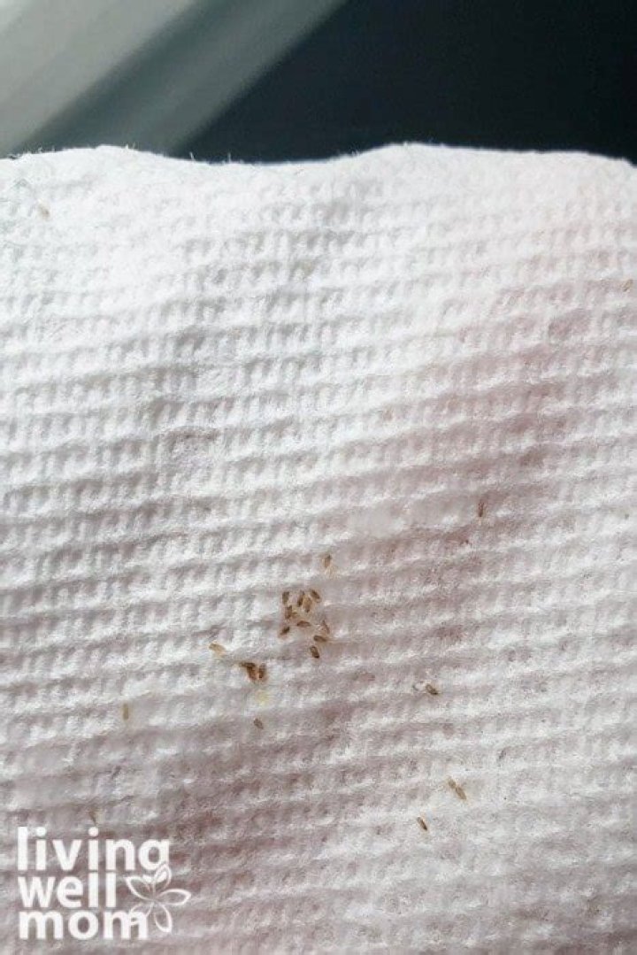 What do paper towel nits look like?