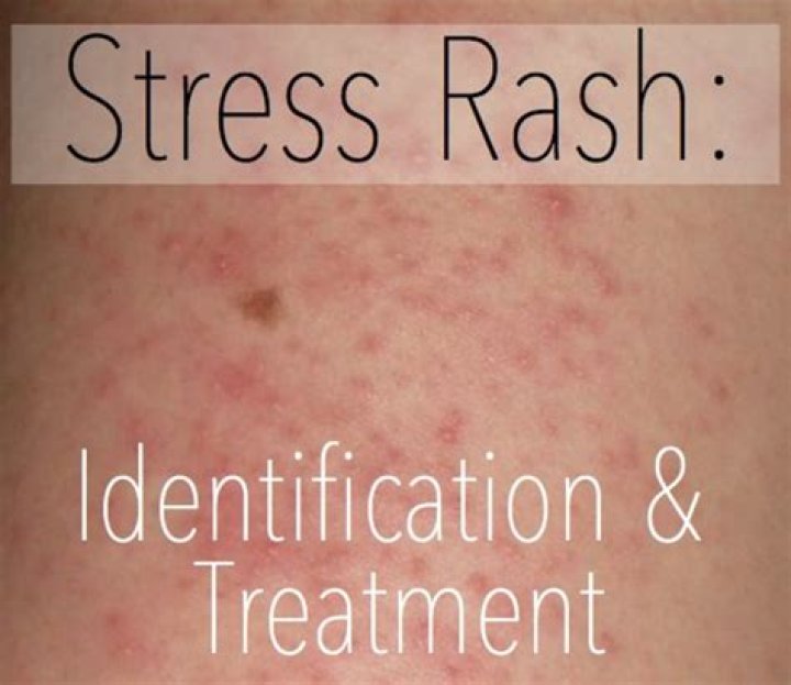 What do stress rashes look like?