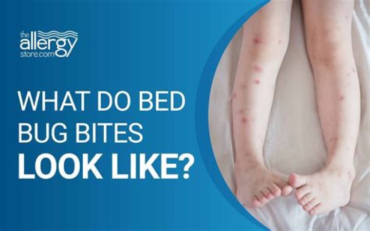 What does a bed bug bite look like on humans?