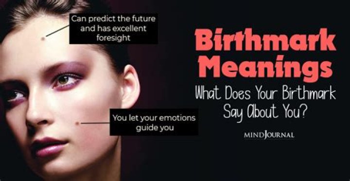 What does a birthmark on your head mean?