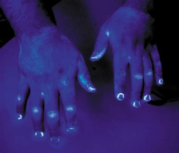 What does a black light show on skin?