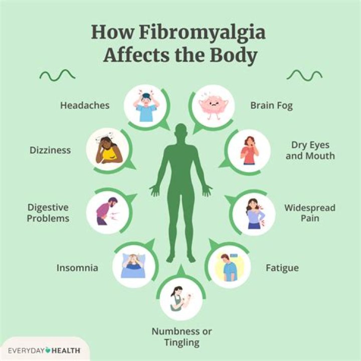 What does a flare up of fibromyalgia feel like?