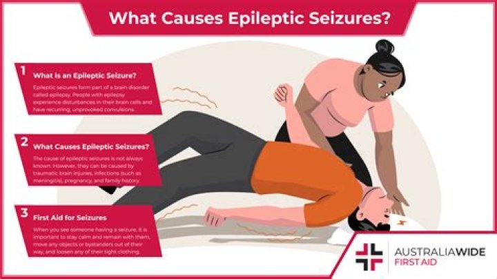 What does a non epileptic seizure look like?