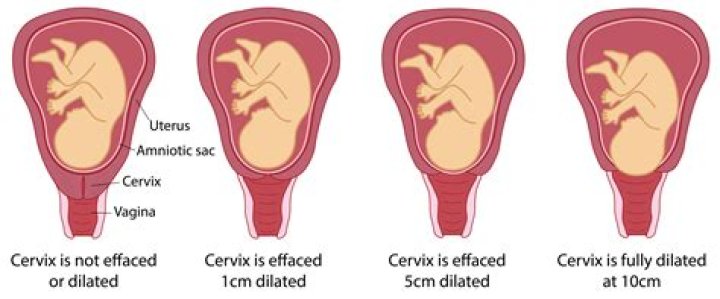 What does a soft cervix feel like?