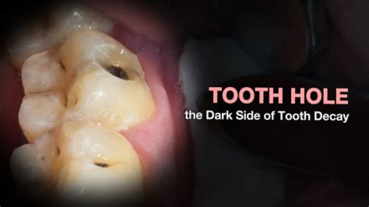 What does an eye tooth look like?