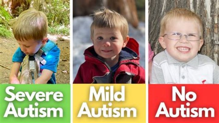 What does ASD look like in toddlers?