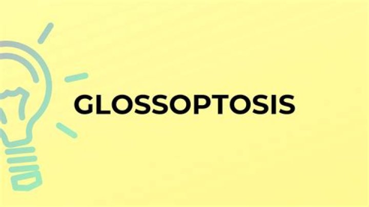 What does glossoptosis mean?