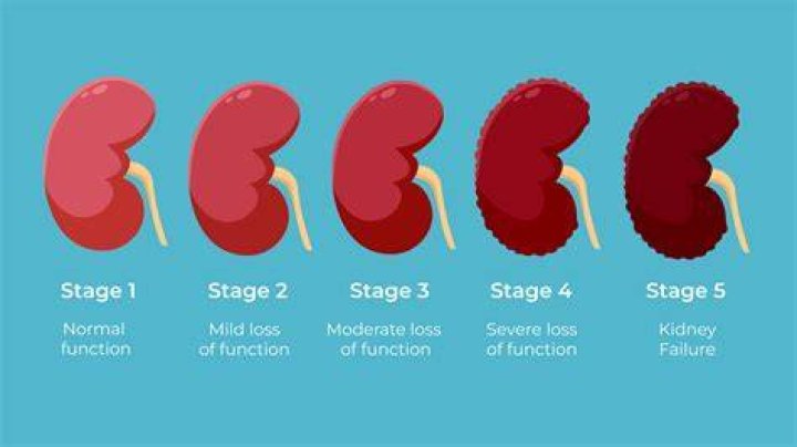 What does it feel like when kidneys shut down?