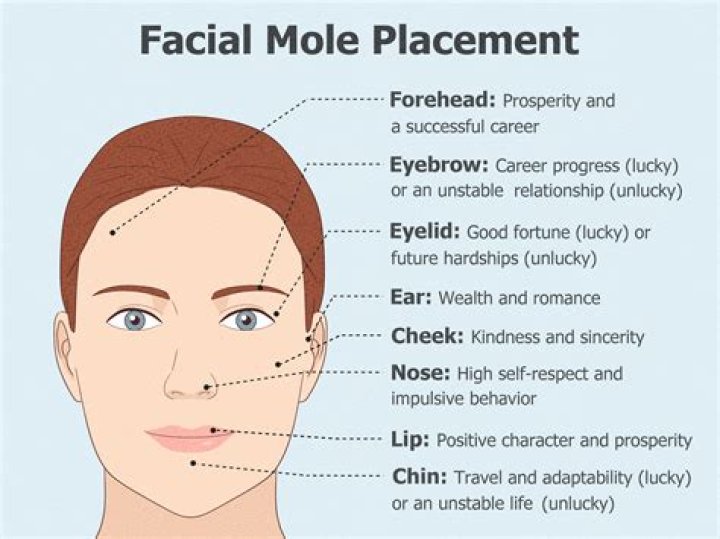 What does mole in right eye mean?