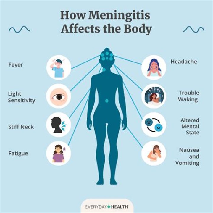 What does the start of meningitis look like?