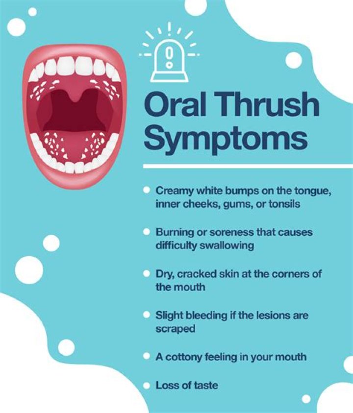 What does thrush in the mouth look like?