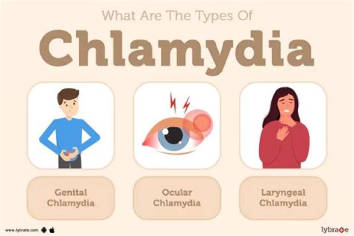 What does your pee smell like if you have chlamydia?