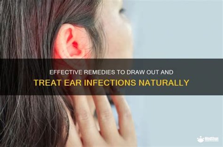 What draws out an ear infection?