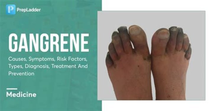 What drug can cause gangrene?