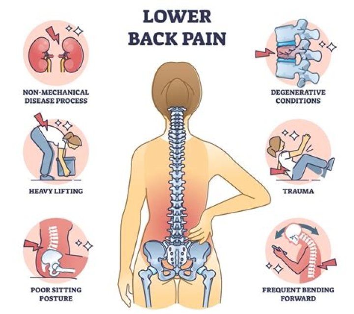What female organs can cause lower back pain?