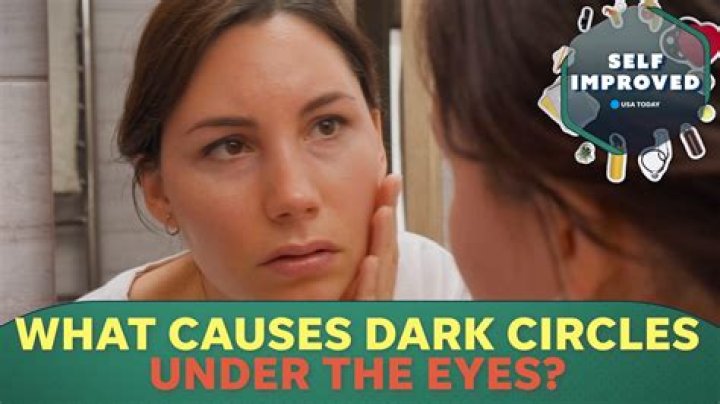 What food causes dark circles?