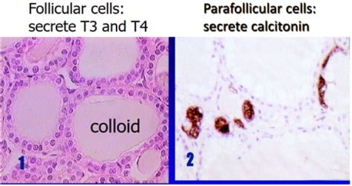 What gland secretes T3 T4 and calcitonin?
