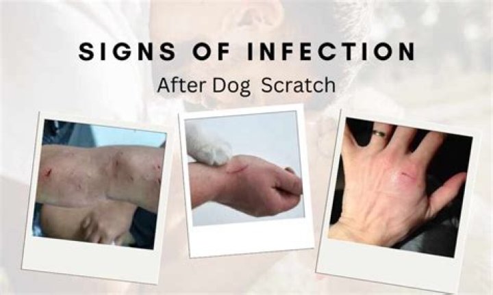 What happens if dog nail scratches you?