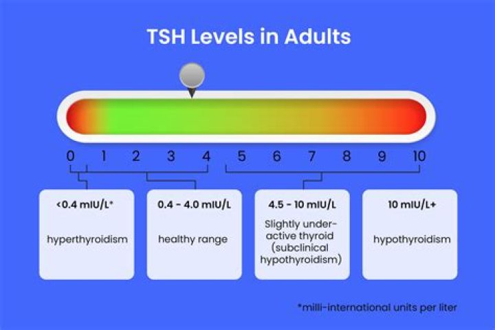What happens if TSH level is high?