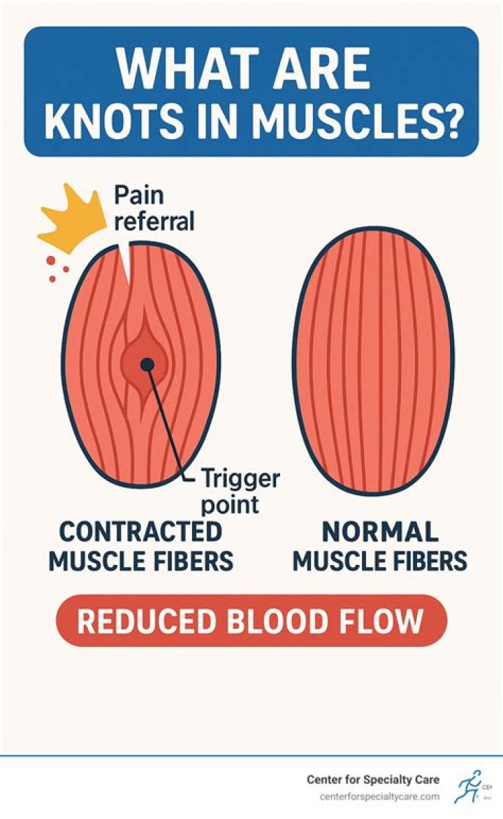 What happens when a muscle knot releases?