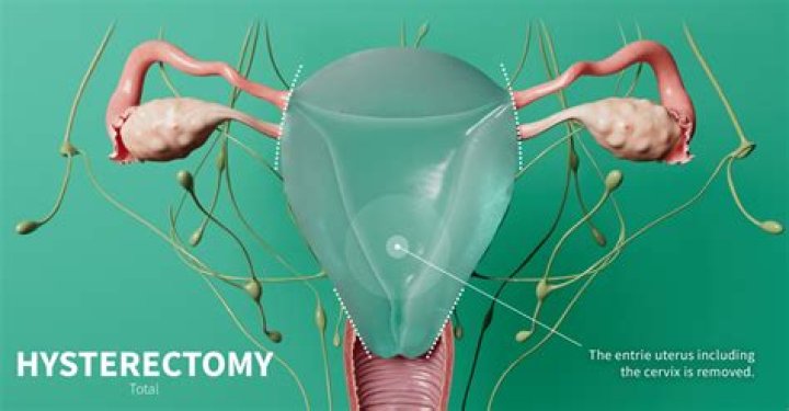 What holds the ovaries in place after a hysterectomy?