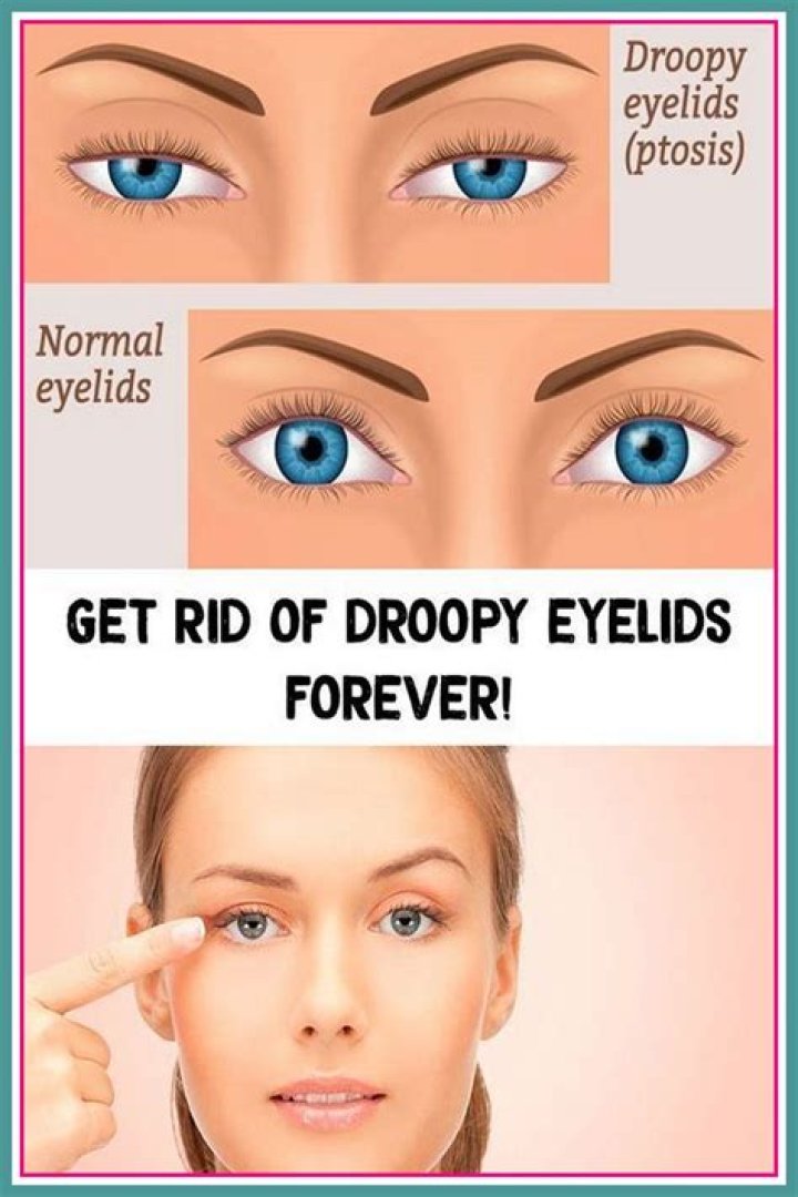 What home remedy can I use for droopy eyelids?