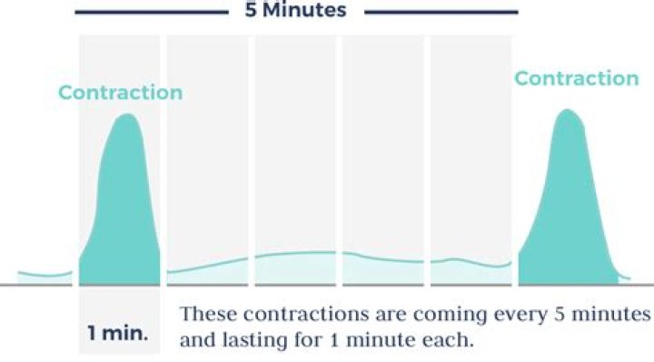 What if my contractions are 5 minutes apart but not painful?