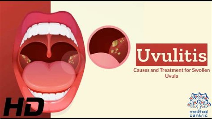 What if my uvula is touching my tongue?