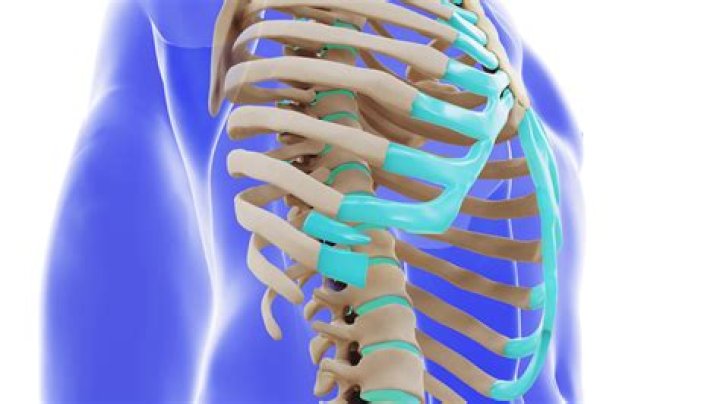 What is 12th rib syndrome?