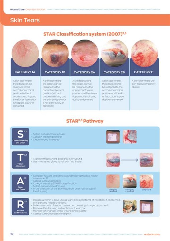 What is a Category 2 skin tear?